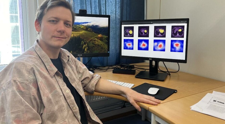 Kunstig intelligens finner leverkreft