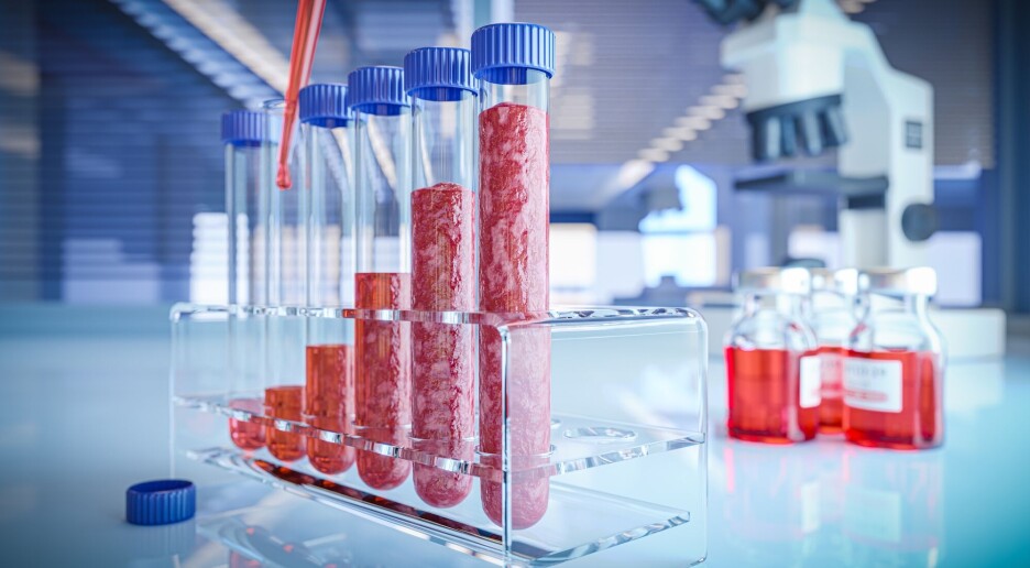 De som ikke liker tanken på laboratorie-kjøtt, har ofte noe annet til felles