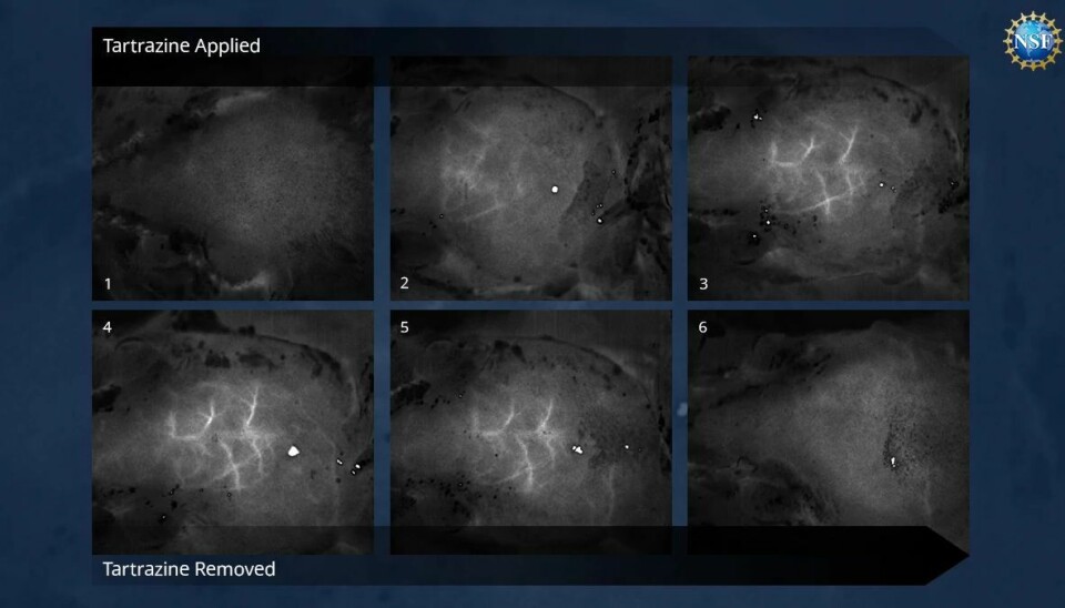 De tre øverste bildene viser hvordan hodet til en mus gradvis blir gjennomsiktig etter at forskerne har gnidd på fargestoffet. På det tredje bildet ser du tydelig blodårene. De tre nederste bildene viser hvordan huden gradvis blir ugjennomsiktig etter at fargestoffet er vasket av. Seks svart-hvitt-bilder av det barberte hodet til en mus. På noen av bildene synes et tydelig nettverk av blodårer over hjernen.