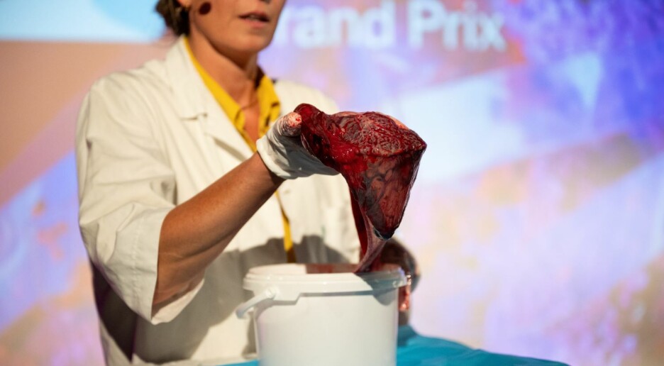 Morkaken er ditt aller viktigste organ