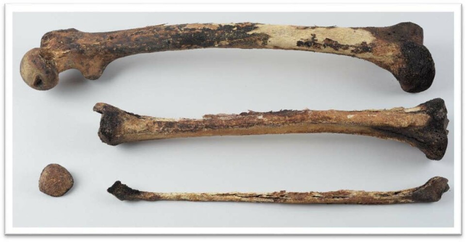 Mange av hvalfangerne som ble gravlagt på Svalbard, døde av skjøbuk. Dette sees her som mørkfarging på leddendene.