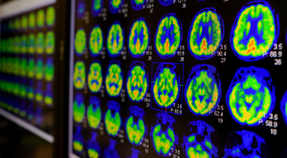 Dette gjorde folk da de fikk vite Alzheimers-risikoen sin