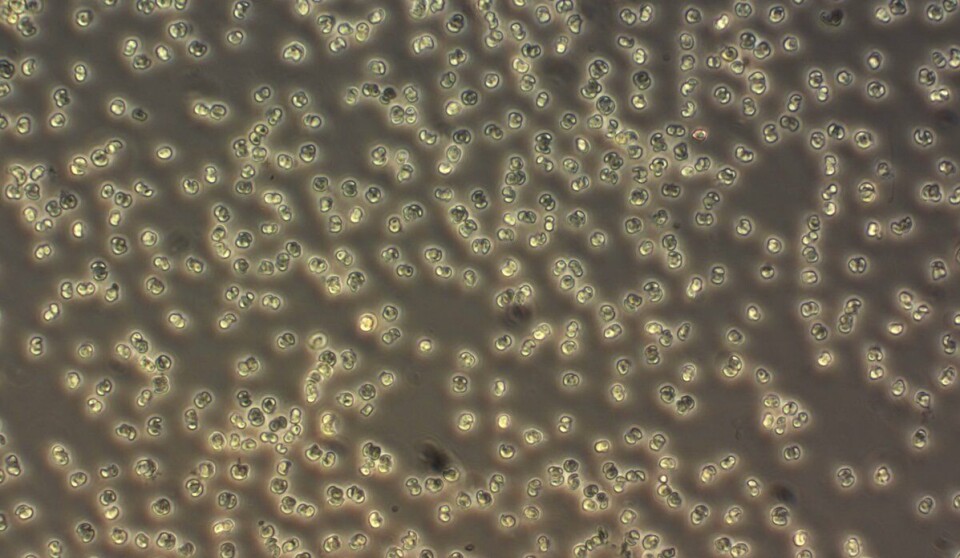 Algen Phaeocystis er en av de to algene som dominerer i algeoppblomstringer i Nord-Norge og fører til at oppdrettsfisk dør. Nærbilde av algen Phaeocystis.