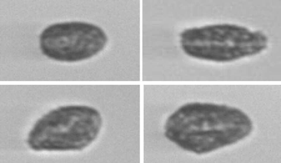 Pseudochattonella-algen har ingen ytre cellevegg og kan derfor være veldig variabel i celleform. Alge