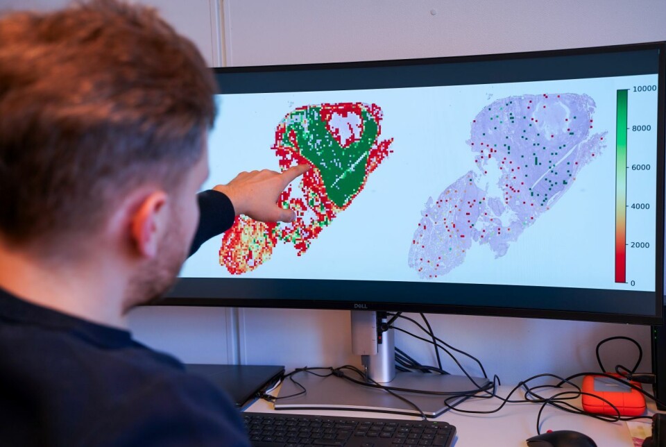 Forsker Nikita Shvetsov har utviklet et KI-system som kan by på mindre kostbare undersøkelser og mer persontilpasset kreftbehandling. Forsker foran PC