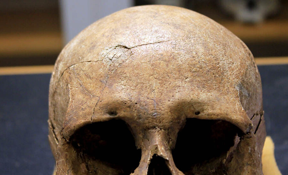 Skjeletter viser vold: Vikingene i Norge døde mer brutalt enn vikinger andre steder