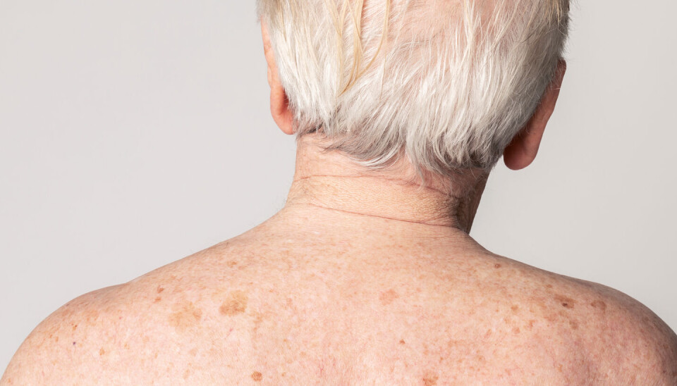 Huden vår produserer fettstoffer. Flere studier har vist at lukten av disse stoffene forandrer seg hos mennesker med Parkinsons. Eldre mann med bare skuldre står med ryggen til.
