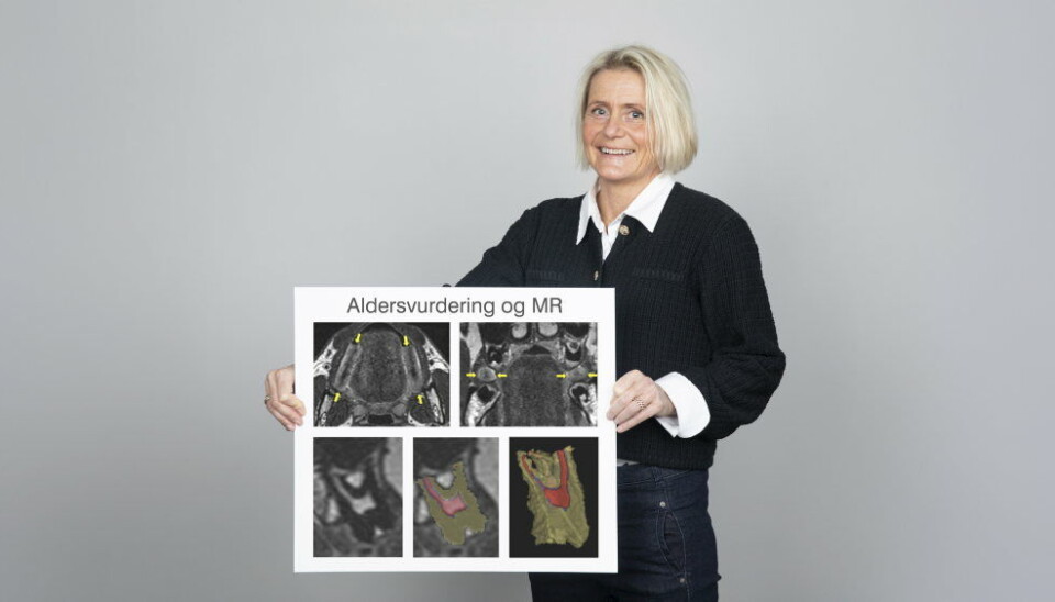 – Det er uetisk å la være å forske på bedre metoder innen aldersvurderinger av barn og unge voksne, særlig når dagens praksis er usikker og omdiskutert, sier forsker og tannlege Mai Britt Bjørk.