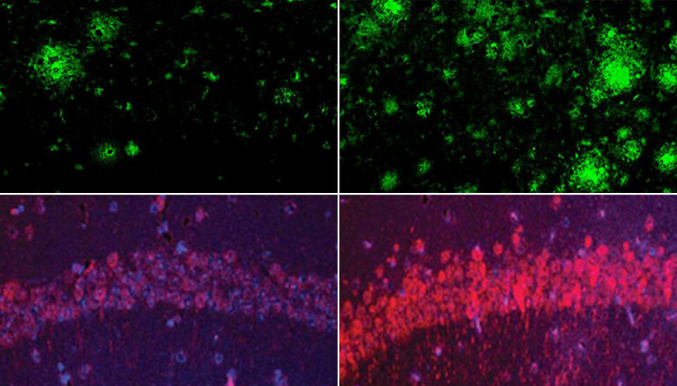 De to øverste bildene viser økt opphopning av amyloide plakk hos en mus med litium-mangel (til høyre), sammenlignet med en mus med normalt nivå (til venstre). De to bildene under viser endring for tau-protein. To bokser viser færre grønne amyloidklynger til venstre og flere til høyre. To andre bokser viser en svak bue av lilla og rødt tau til venstre og en sterkere bue til høyre.