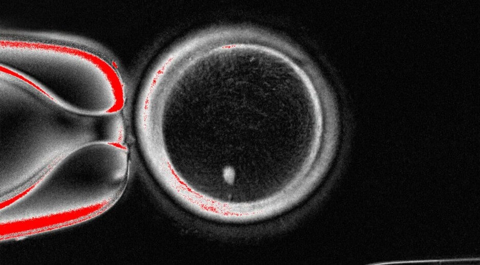 Lagde embryoer fra hudceller: – Kan hjelpe kvinner med å få egne biologiske barn, sier forsker