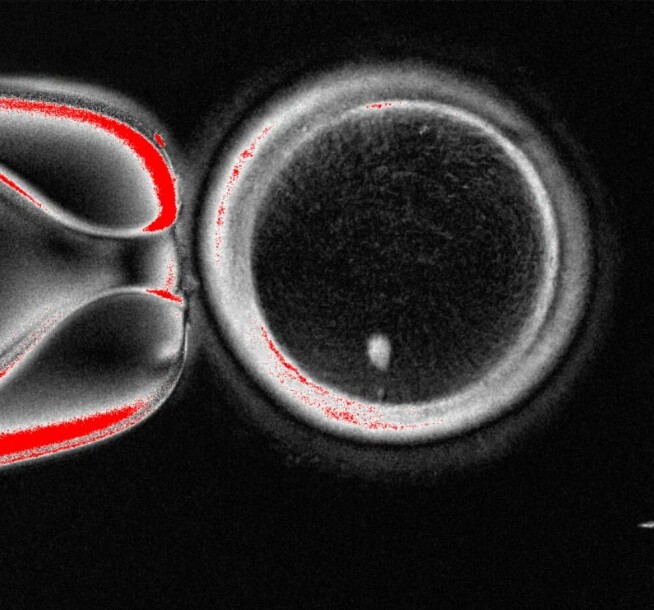 Brukte hudceller til å lage menneske-embryo