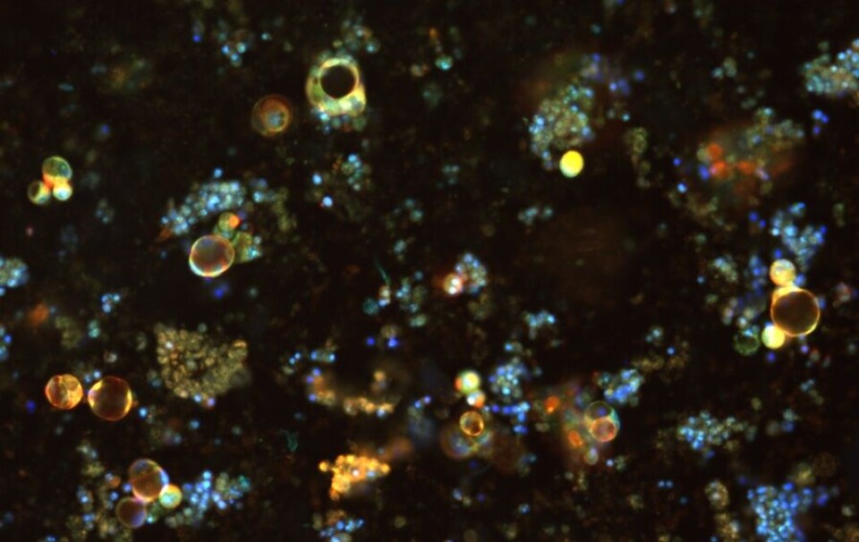 Dette er mini-svulster som vokser på laboratoriet, hentet fra en pasient med tykktarmskreft. – Målet er å videreutvikle teknikken til å kunne oppdage forskjeller som er av betydning, men som et menneske ikke ville lagt merke til ved tradisjonell lysmikroskopi, sier lege og sivilingeniør Flobak.