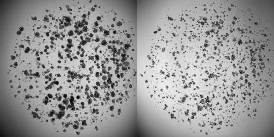 Kreftceller på laboratorier. Til venstre ser vi kreftceller som har vokst i en uke uten tilsetning av medisiner. Til høyre ser vi kreftceller fra samme pasient etter å å ha blitt utsatt for cellegift.
