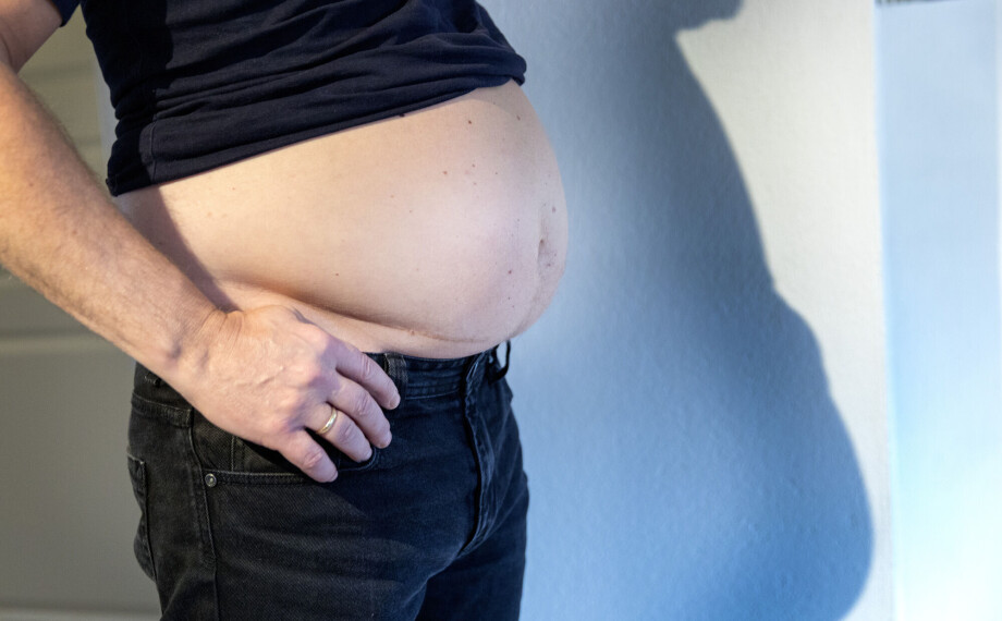 Bukfedme gir stor helsefare hos normalvektige, advarer forskere