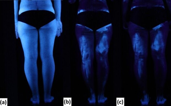 Her ser vi en av forsøksdeltakerne bakfra i blacklight før og etter at hun har smurt seg inn med solkrem. A: Ingen solkrem. B: Ett lag solkrem. C: Dobbelt lag solkrem. (Foto: Heerfordt et al. utgitt i PLoS ONE) Her ser vi en av forsøksdeltakerne bakfra i blacklight før og etter at hun har smurt seg inn med solkrem. A: Ingen solkrem. B: Ett lag solkrem. C: Dobbelt lag solkrem. (Foto: Heerfordt et al. utgitt i PLoS ONE)