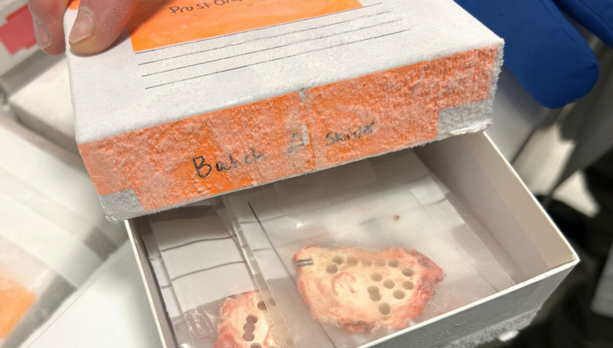 Slik avslørte forskerne aggressiv prostatakreft