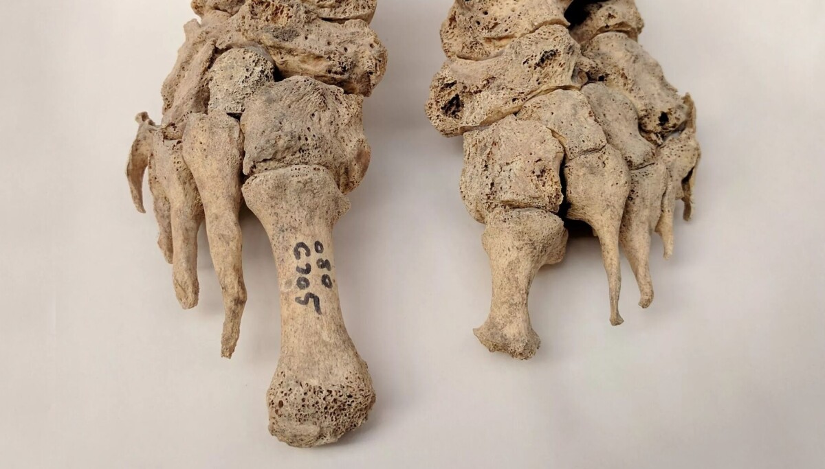 Arkeologer fant noe overraskende på flere kirkegårder fra middelalderen i Danmark