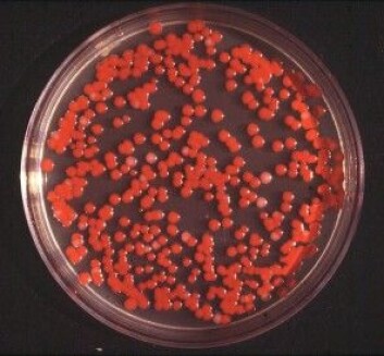 Dette er bakterien som har laget knallrødt pigment i en agar-kultur. (Foto: Creative Commons Attribution-Share Alike 3.0 Unported) Dette er bakterien som har laget knallrødt pigment i en agar-kultur. (Foto: Creative Commons Attribution-Share Alike 3.0 Unported)