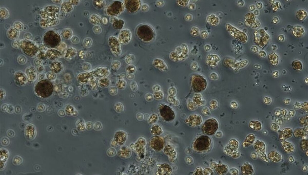 Giftige alger inntar Oslofjorden