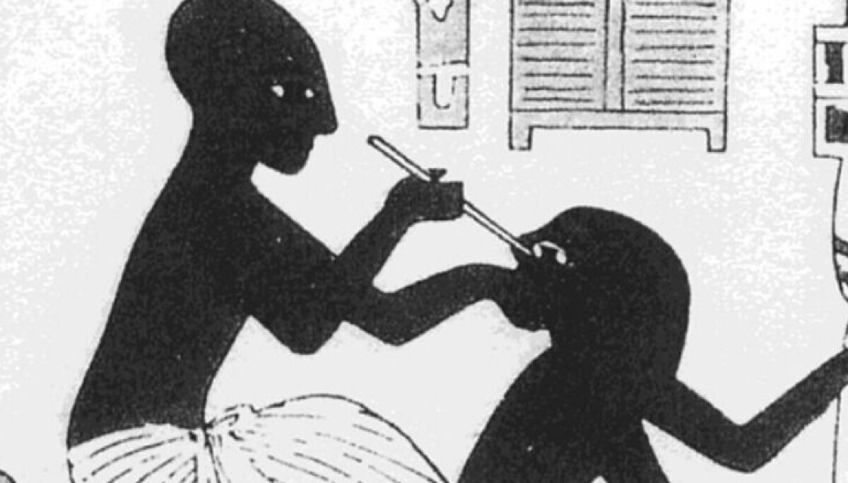 I dag er dette en enkel og smertefri operasjon, men slik har det ikke alltid vært