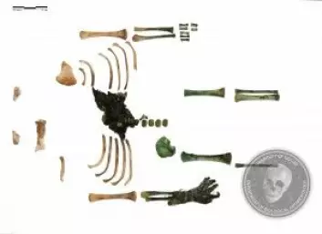 Her er alle kroppsdelene arkeologene fant. Noen er grønnfarget av kobberet.<br>(Foto: Universitetet i Szeged)