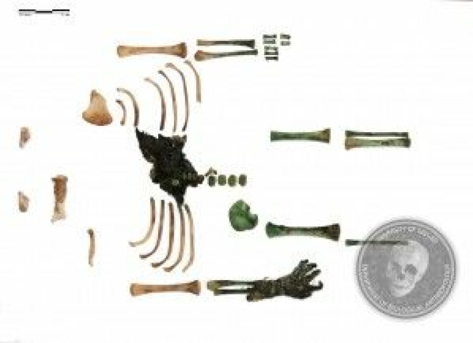 Her er alle kroppsdelene arkeologene fant. Noen er grønnfarget av kobberet.(Foto: Universitetet i Szeged)