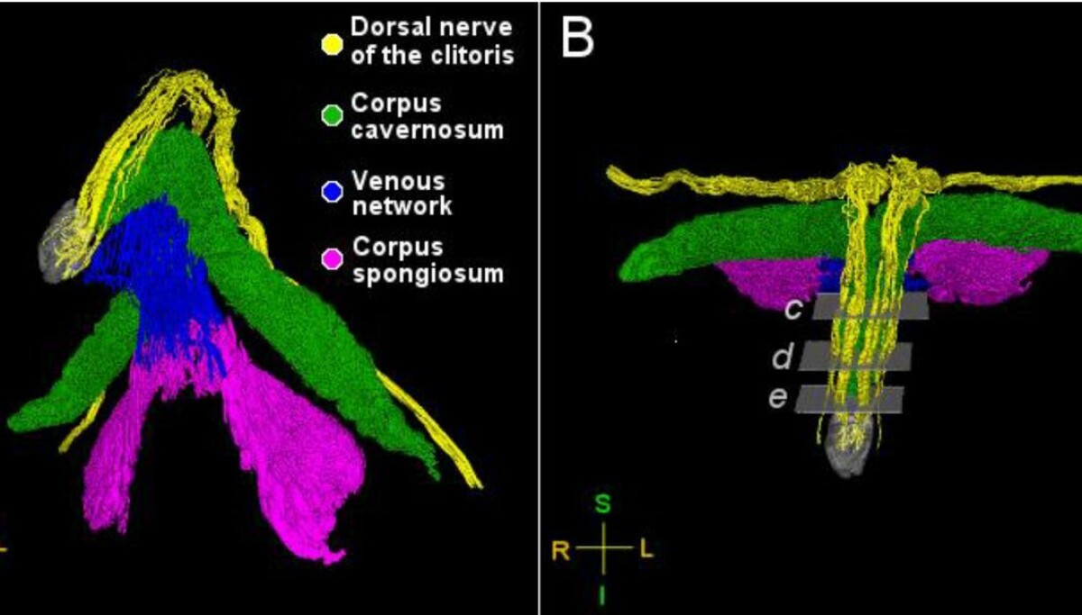 Her er første 3D-bilde av klitoris: – Mannlige og kvinnelige kjønnsorganer er ganske like, sier professor