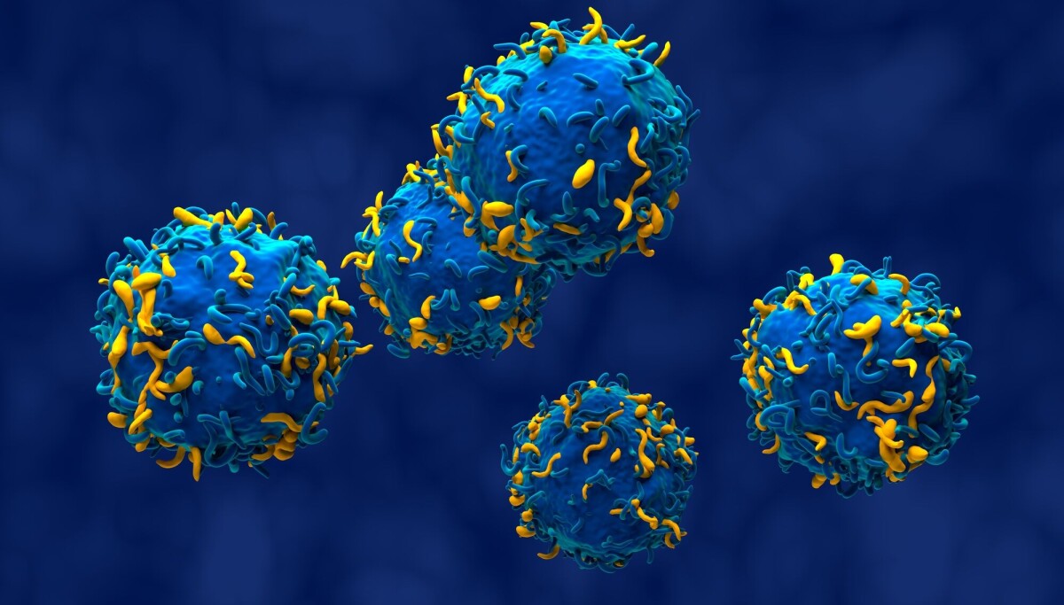 Kvinne fikk ny behandling mot tre autoimmune sykdommer