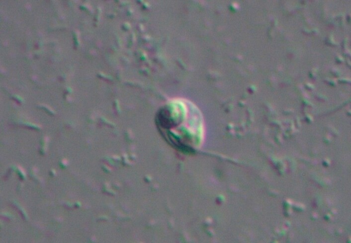 Den encellete <em>Ancoracysta twista</em>. (Foto: Denis V. Tiknonenkov) Den encellete <em>Ancoracysta twista</em>. (Foto: Denis V. Tiknonenkov)