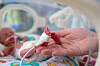 Prematur baby i kuvøse med sensor til pulsoksimeter holdt av en hånd.