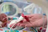 Prematur baby i kuvøse med sensor til pulsoksimeter holdt av en hånd.