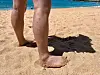 Nærbilde av ben med røde prikker og irritert hud på en sandstrand.