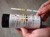Hender holder en hvit, lang, tynn urinstix dekket med firkanter med farger fra lyst, via gult, grønt og turkis. Den holdes over en flaske med fargeskala for urinanalyse.