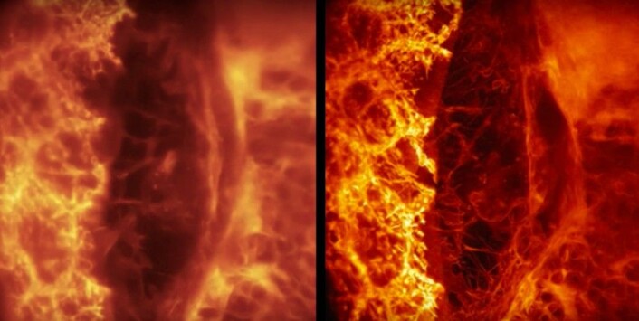 Bedre skarphet: Til venstre uten og til høyre med adaptiv optikk. Bildene viser endocytose – altså hvordan proteiner fraktes inn i en celle. (Foto: Fra YouTube-video publisert av HHMI Howard Hughes Medical Institute) Bedre skarphet: Til venstre uten og til høyre med adaptiv optikk. Bildene viser endocytose – altså hvordan proteiner fraktes inn i en celle. (Foto: Fra YouTube-video publisert av HHMI Howard Hughes Medical Institute)