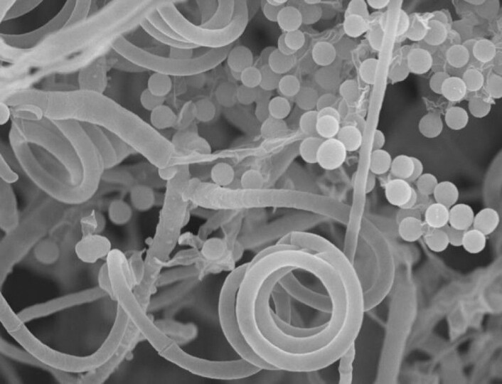 Slik ser fotsoppen Trichophyton ut i et elektronmikroskop. (Foto: Wenjun Li and Joseph Heitman - Duke University, and Valerie Lapham - North Carolina State University) Slik ser fotsoppen Trichophyton ut i et elektronmikroskop. (Foto: Wenjun Li and Joseph Heitman - Duke University, and Valerie Lapham - North Carolina State University)