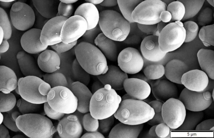 <em>Saccharomyces cerevisiae</em> sett gjennom et elektronmikroskop. (Foto: Mogana Das Murtey og Patchamuthu Ramasamy, Creative Commons <a href="https://creativecommons.org/licenses/by-sa/3.0/deed.en">BY-SA 3.0</a>) <em>Saccharomyces cerevisiae</em> sett gjennom et elektronmikroskop. (Foto: Mogana Das Murtey og Patchamuthu Ramasamy, Creative Commons <a href="https://creativecommons.org/licenses/by-sa/3.0/deed.en">BY-SA 3.0</a>)