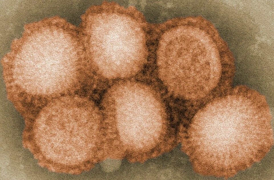 Slik ser et influensavirus ut i elektronmikroskop. Bildet er kunstig fargelagt. (Bilde: Cybercobra at English Wikipedia, CC-BY-SA 3.0)