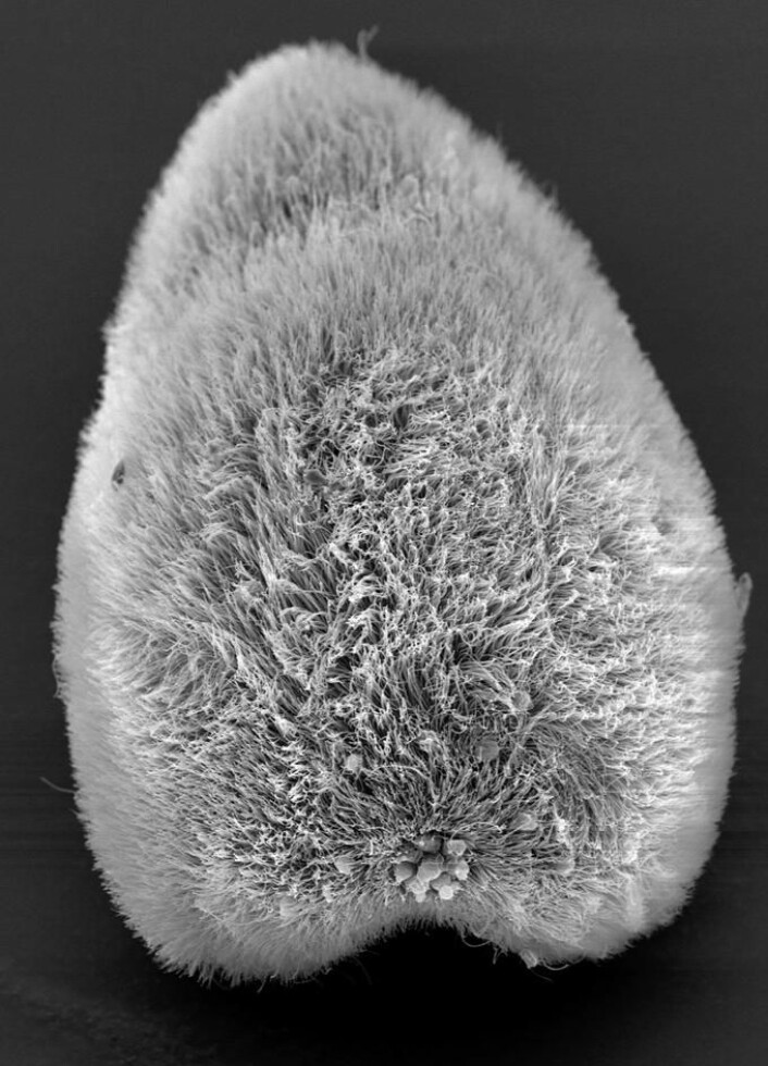 Eit forstørra bilete av ein acoel-makk. – Den ser ut som ein tribble frå Star Trek, men er mykje mindre, berre 150 mikrometer. Vi ser på framparten, eller andletet, der ein kjertel og sanse-celler er plasserte, forklarar Hejnol. (Foto: The Sars International Centre for Marine Molecular Biology / UiB) Eit forstørra bilete av ein acoel-makk. – Den ser ut som ein tribble frå Star Trek, men er mykje mindre, berre 150 mikrometer. Vi ser på framparten, eller andletet, der ein kjertel og sanse-celler er plasserte, forklarar Hejnol. (Foto: The Sars International Centre for Marine Molecular Biology / UiB)