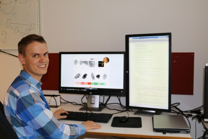 Andreas Kleppe viser hvordan bildeanalyse kan brukes i diagnostisering og behandling av mange kreftformer. (Foto: Gunhild M. Haugnes / UiO) Andreas Kleppe viser hvordan bildeanalyse kan brukes i diagnostisering og behandling av mange kreftformer. (Foto: Gunhild M. Haugnes / UiO)