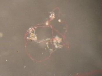 Både i prøvene fra vannet og i prøvene hos fiskene kunne vi se at 90 prosent av plasten er fibre som kunne stamme fra klesvask. Les mer i boksen under artikkelen. (Foto: DTU) Både i prøvene fra vannet og i prøvene hos fiskene kunne vi se at 90 prosent av plasten er fibre som kunne stamme fra klesvask. Les mer i boksen under artikkelen. (Foto: DTU)