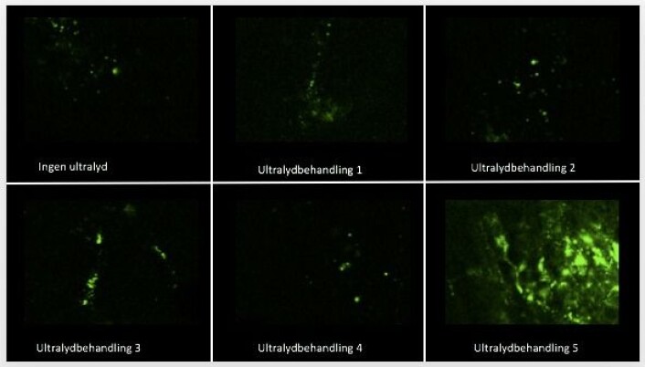 For å få boblene til å oppføre seg som de ville, testet forskerne mange ulike ultralydbehandlinger, og målte hvor mye nanopartikler som ble levert til kreftvev i mus. Mange av ultralybehandlingene hadde liten effekt, men Sofie Snipstad fant én som fungerte svært bra. (Foto: NTNU) For å få boblene til å oppføre seg som de ville, testet forskerne mange ulike ultralydbehandlinger, og målte hvor mye nanopartikler som ble levert til kreftvev i mus. Mange av ultralybehandlingene hadde liten effekt, men Sofie Snipstad fant én som fungerte svært bra. (Foto: NTNU)