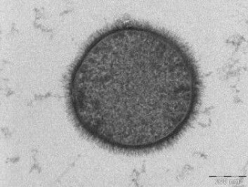Bacillus subtilis er en svært robust bakterie. Men den kan likevel ikke tåle forholdene på overflaten av Mars. I hvert fall ikke så lenge den befinner seg i sitt aktive stadium. (Foto: Allon Weiner/The Weizmann Institute of Science) Bacillus subtilis er en svært robust bakterie. Men den kan likevel ikke tåle forholdene på overflaten av Mars. I hvert fall ikke så lenge den befinner seg i sitt aktive stadium. (Foto: Allon Weiner/The Weizmann Institute of Science)