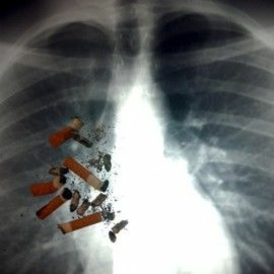 Lungekreft er bare en av mange dødelige sykdommer som kan følge av sigarettrøyking. Antakelig dør mellom halvparten og to tredeler av alle røykere av sigarettene. (Illustrasjonsfoto: www.colourbox.no)