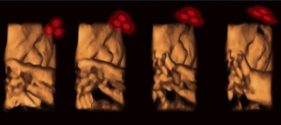 Dette er 4D-ultralyd av et foster som følger med når synssansen blir pirret av de tre røde prikkene. (Foto: Kirsty Dunn og Vincent Reid)