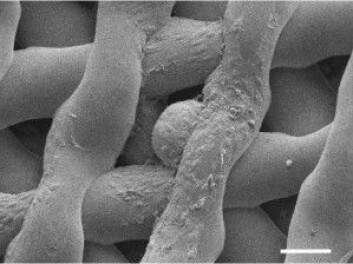 Et mikroskopisk foto av et umodent museegg som er omgitt av follikler etter å ha vært innsatt i den kunstige eggstokken i seks dager. (Foto: Northwestern University) Et mikroskopisk foto av et umodent museegg som er omgitt av follikler etter å ha vært innsatt i den kunstige eggstokken i seks dager. (Foto: Northwestern University)