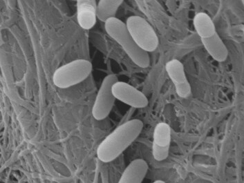 "E. coli finnes normalt i tarmen hos dyr og mennesker, men noen spesielle typer kan gjøre oss syke. Foto: Margarita Novoa Garrido og Steinar Stølen." "E. coli finnes normalt i tarmen hos dyr og mennesker, men noen spesielle typer kan gjøre oss syke. Foto: Margarita Novoa Garrido og Steinar Stølen."